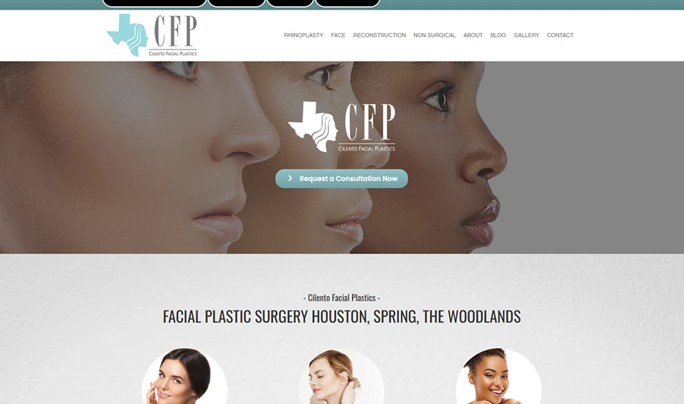 Cilento Facial Plastics - new case studies - image (1)