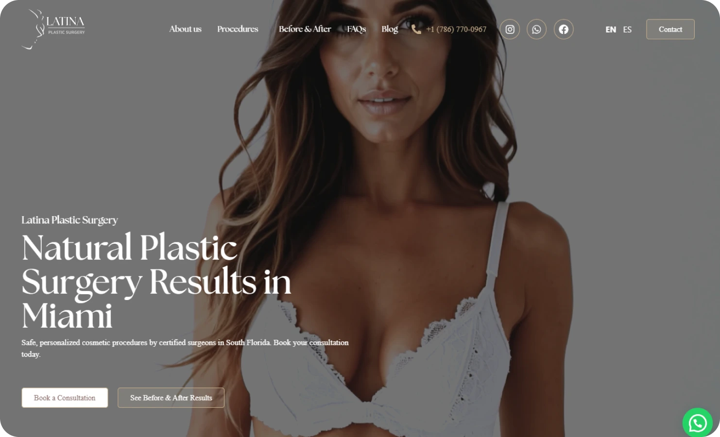 Latina Plastic Surgery - new case image (8)